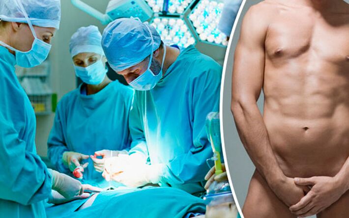 Chirurgesch Erhéijung vun de Penis